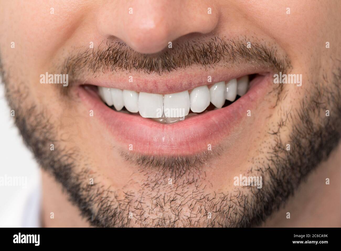 Homme au sourire naturel avec une dentition alignée et des dents saines